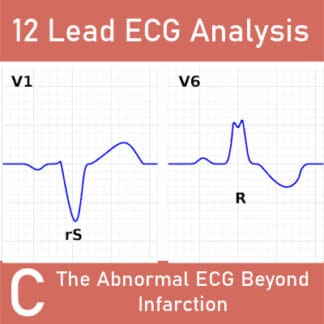 12 Lead ECG Analysis C: The Abnormal ECG Beyond Infarction