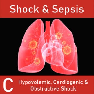 Shock & Sepsis C: Hypovolemic ,Cardiogenic, & Obstructive Shock
