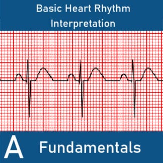 Basic Heart Rhythm Interpretation A: Fundamentals