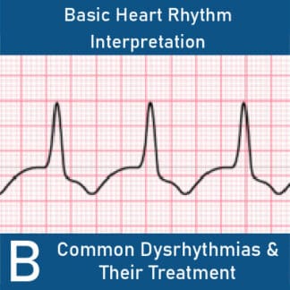 Basic Heart Rhythm Interpretation...Made Simple! B: Common Dysrhythmias and their Treatment