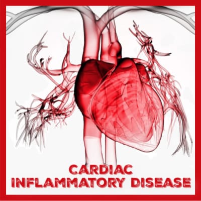 Cardiac Inflammatory Disease (IHD)