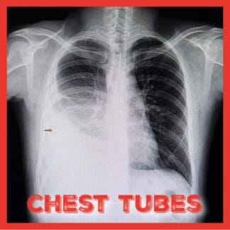 Breathe Easy: Chest Tubes In The Acute Care Patient