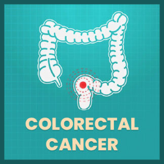 October 27: Colorectal Cancer: Beyond the Scope